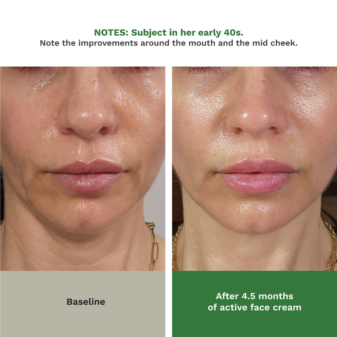 Adipeau  Volume Cream