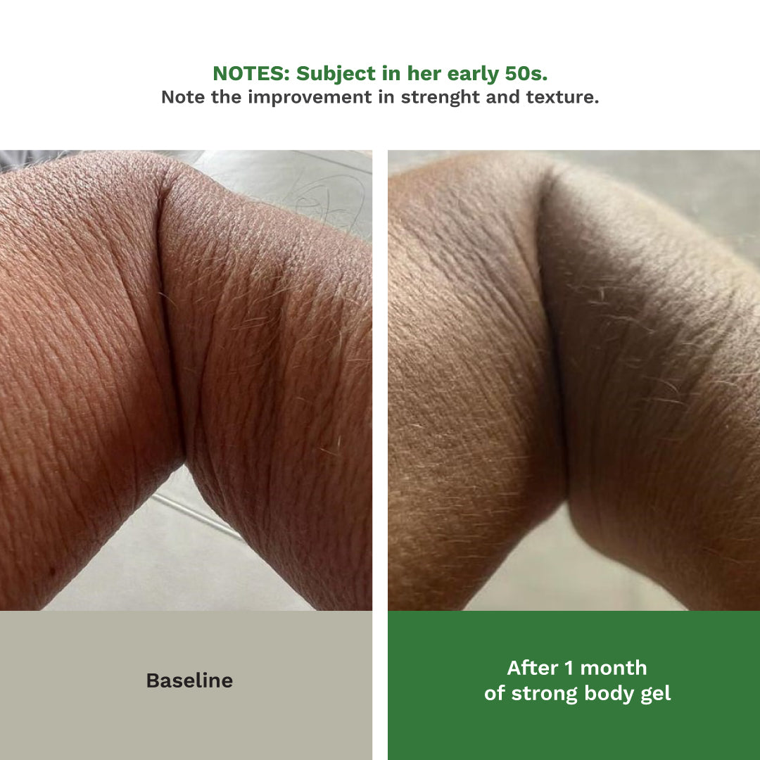 Adipeau  Strong Body Gel